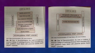 Management of heart failure with preserved ejection fraction | PPTX