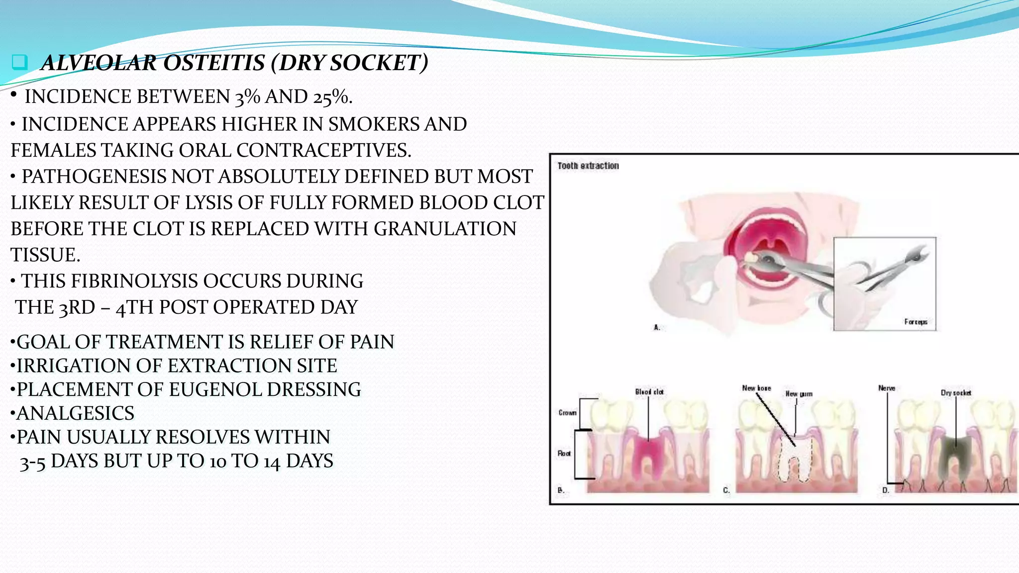  ALVEOLAR OSTEITIS (DRY SOCKET)
• INCIDENCE BETWEEN 3% AND 25%.
• INCIDENCE APPEARS HIGHER IN SMOKERS AND
FEMALES TAKING ORAL CONTRACEPTIVES.
• PATHOGENESIS NOT ABSOLUTELY DEFINED BUT MOST
LIKELY RESULT OF LYSIS OF FULLY FORMED BLOOD CLOT
BEFORE THE CLOT IS REPLACED WITH GRANULATION
TISSUE.
• THIS FIBRINOLYSIS OCCURS DURING
THE 3RD – 4TH POST OPERATED DAY
•GOAL OF TREATMENT IS RELIEF OF PAIN
•IRRIGATION OF EXTRACTION SITE
•PLACEMENT OF EUGENOL DRESSING
•ANALGESICS
•PAIN USUALLY RESOLVES WITHIN
3-5 DAYS BUT UP TO 10 TO 14 DAYS
 