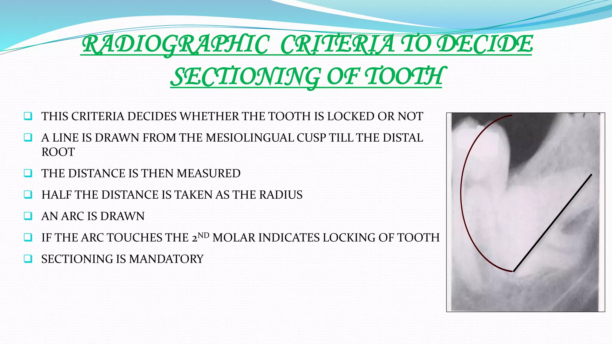 RADIOGRAPHIC CRITERIA TO DECIDE
SECTIONING OF TOOTH
 THIS CRITERIA DECIDES WHETHER THE TOOTH IS LOCKED OR NOT
 A LINE IS DRAWN FROM THE MESIOLINGUAL CUSP TILL THE DISTAL
ROOT
 THE DISTANCE IS THEN MEASURED
 HALF THE DISTANCE IS TAKEN AS THE RADIUS
 AN ARC IS DRAWN
 IF THE ARC TOUCHES THE 2ND MOLAR INDICATES LOCKING OF TOOTH
 SECTIONING IS MANDATORY
 