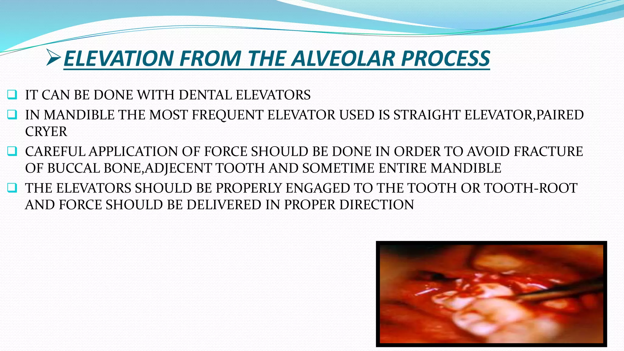 ELEVATION FROM THE ALVEOLAR PROCESS
 IT CAN BE DONE WITH DENTAL ELEVATORS
 IN MANDIBLE THE MOST FREQUENT ELEVATOR USED IS STRAIGHT ELEVATOR,PAIRED
CRYER
 CAREFUL APPLICATION OF FORCE SHOULD BE DONE IN ORDER TO AVOID FRACTURE
OF BUCCAL BONE,ADJECENT TOOTH AND SOMETIME ENTIRE MANDIBLE
 THE ELEVATORS SHOULD BE PROPERLY ENGAGED TO THE TOOTH OR TOOTH-ROOT
AND FORCE SHOULD BE DELIVERED IN PROPER DIRECTION
 
