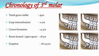 Chronology of 3rd molar
 Tooth germ visible – 9yrs
 Cusp mineralization – 11 yrs
 Crown formation – 14 yrs
 Roots formed (apex open) – 18 yrs
 Eruption – 18-24 yrs
 