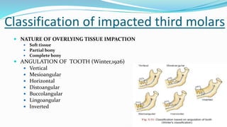 Classification of impacted third molars
 NATURE OF OVERLYING TISSUE IMPACTION
 Soft tissue
 Partial bony
 Complete bony
 ANGULATION OF TOOTH (Winter,1926)
 Vertical
 Mesioangular
 Horizontal
 Distoangular
 Buccolangular
 Lingoangular
 Inverted
 
