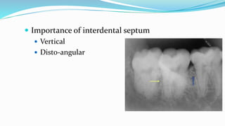 Importance of interdental septum
 Vertical
 Disto-angular
 