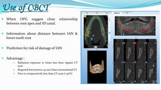 Use of CBCT
 When OPG suggest close relationship
between root apex and ID canal.
 Information about distance between IAN &
lower tooth root
 Prediction for risk of damage of IAN
 Advantage :
 Radiation exposure 10 times less than regular CT
scan
 Required less time(10-40 sec) than conventional CT
 Price is comparatively less than CT scan (<50%)
 
