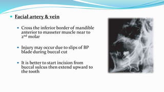 Facial artery & vein
 Cross the inferior border of mandible
anterior to masseter muscle near to
2nd molar
 Injury may occur due to slips of BP
blade during buccal cut
 It is better to start incision from
buccal sulcus then extend upward to
the tooth
 