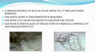  A TRINGULAR PIECE OF BUCCAL PLATE DISTAL TO 2ND MOLAR IS THEN
REMOVED
 THE DISTAL BONE IS THEN REMOVED IF REQUIRED
 THE BONY CUT CAN BE ENLARGED TO UNCOVER THE TOOTH
 ELEVATOR IS THEN PLACED AT THE JUCTION OF VERRTICAL LIMITING CUT
AND OBLIQUE BONE CUT
 