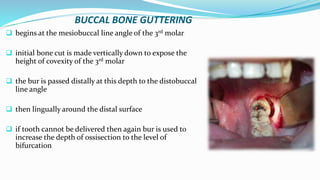 BUCCAL BONE GUTTERING
 begins at the mesiobuccal line angle of the 3rd molar
 initial bone cut is made vertically down to expose the
height of covexity of the 3rd molar
 the bur is passed distally at this depth to the distobuccal
line angle
 then lingually around the distal surface
 if tooth cannot be delivered then again bur is used to
increase the depth of ossisection to the level of
bifurcation
 