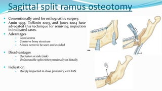 Sagittal split ramus osteotomy
 Conventionally used for orthognathic surgery.
 Amin 1995, Toffanin 2003, and Jones 2004 have
advocated this technique for remiving impaction
in indicated cases.
 Advantages
 Good access
 Conserve bony structure
 Allows nerve to be seen and avoided
 Disadvantages
 Occlusion at risk (risk)
 Unfavourable split either proximally or distally
 Indication:
 Deeply impacted in close proximity with IAN
 