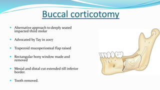 Buccal corticotomy
 Alternative approach to deeply seated
impacted third molar
 Advocated by Tay in 2007
 Trapezoid mucoperiosteal flap raised
 Rectangular bony window made and
removed
 Mesial and distal cut extended till inferior
border.
 Tooth removed.
 