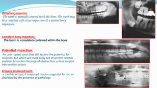 Partial bony impaction:
The tooth is partially covered with the bone. The tooth may
be a complete soft tissue impaction & a partial bony
impaction.
Complete bony impaction:
The tooth is completely contained within the bone
Potential impaction:
An unerrupted tooth that still retains the potential for
eruption, but which will most likely not erupt into normal
position & function because of obstruction, unless surgical
intervention occurs.
Ectopic/ displaced teeth:
a tooth is ectopic if malposed due to congenital factors or
displaced by the presence of pathology.
 