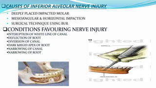 CAUSES OF INFERIOR ALVEOLAR NERVE INJURY
 DEEPLY PLACED IMPACTED MOLAR
 MESIOANGULAR & HORIZONTAL IMPACTION
 SURGICAL TECHNIQUE USING BUR
CONDITIONS FAVOURING NERVE INJURY
INTERUPTION OF WHITE LINE OF CANAL
DEFLECTION OF ROOT
DIVERSION OF CANAL
DARK &RIGID APEX OF ROOT
NARROWING OF CANAL
NARROWING OF ROOT
 