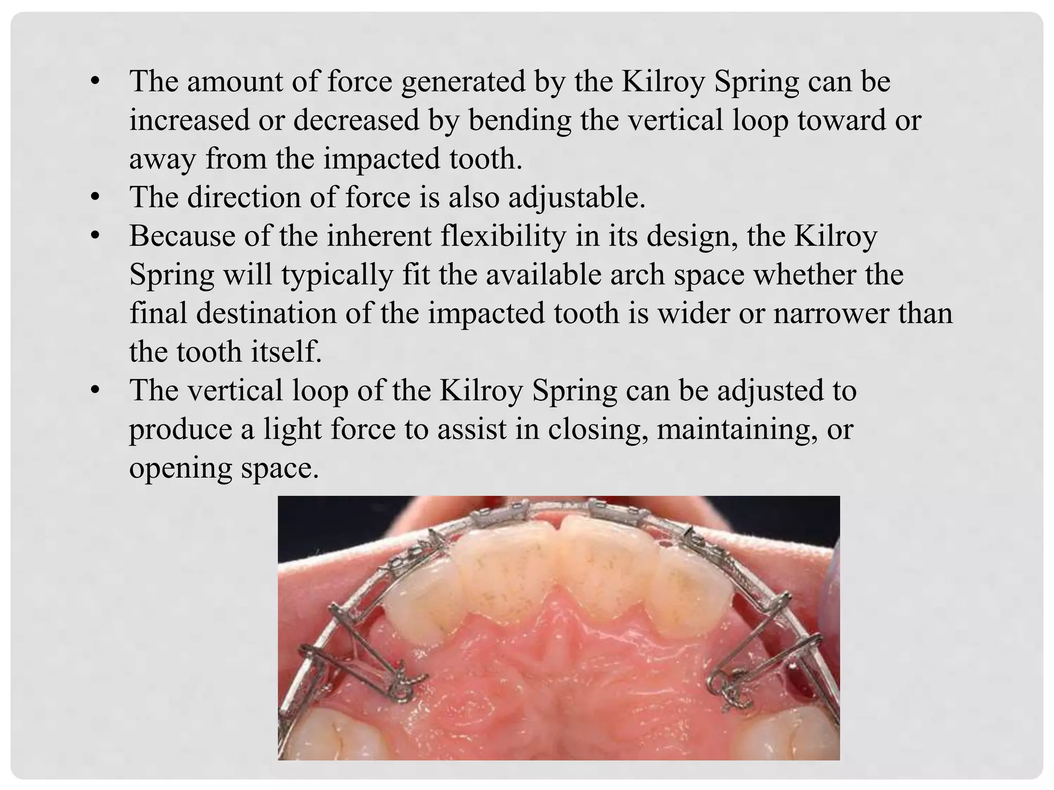 Management of impacted canines | PPTX