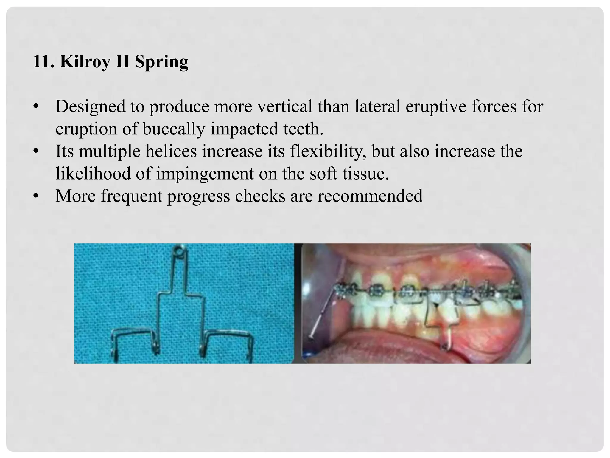 Management of impacted canines | PPTX