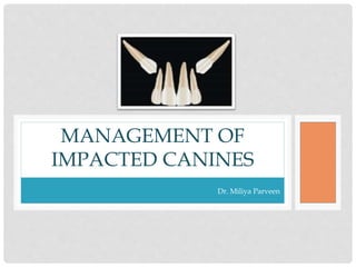 Dr. Miliya Parveen
MANAGEMENT OF
IMPACTED CANINES
 