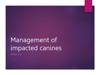 Management of
impacted canines
AIMEE LIU
 