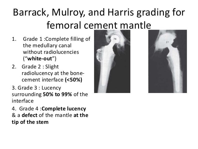 Management of infected total hip replacement