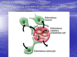 Management of Intercranial Pressure