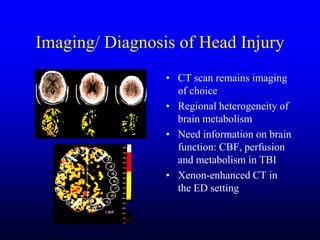 Management of Intercranial Pressure