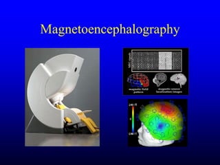 Management of Intercranial Pressure