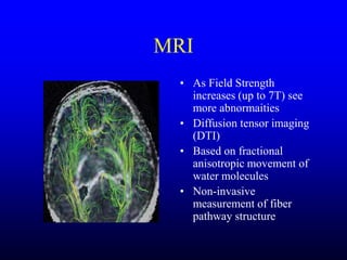 Management of Intercranial Pressure