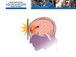 Management of Intercranial Pressure