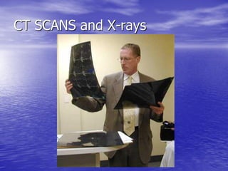 Management of Intercranial Pressure