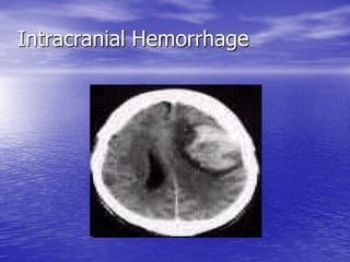 Management of Intercranial Pressure