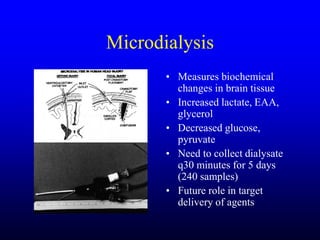 Management of Intercranial Pressure