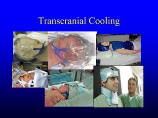 Management of Intercranial Pressure