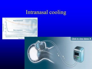 Management of Intercranial Pressure