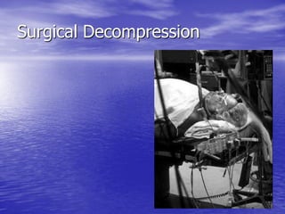 Management of Intercranial Pressure