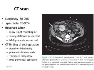 Management of Intestinal Obstruction In Adult.pptx