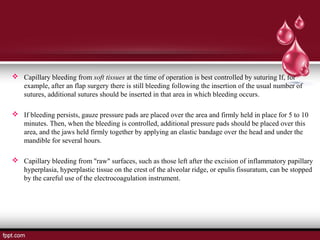 Management of intraoral bleeding | PPT