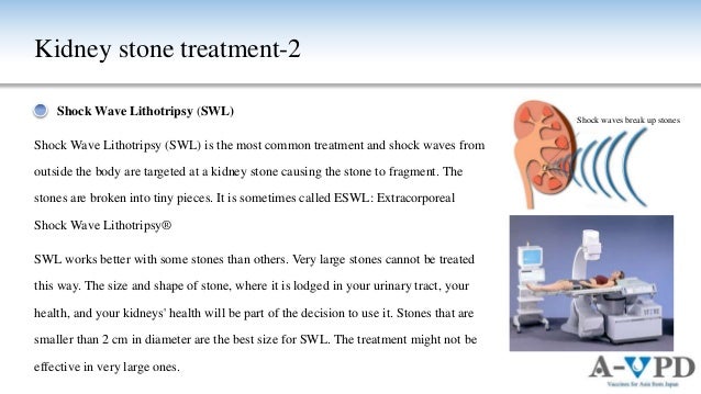 Management Of Kidney Stones And Jin Product Information