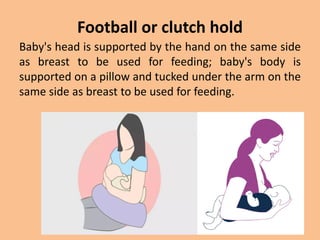 Football or clutch hold
Baby's head is supported by the hand on the same side
as breast to be used for feeding; baby's body is
supported on a pillow and tucked under the arm on the
same side as breast to be used for feeding.
 