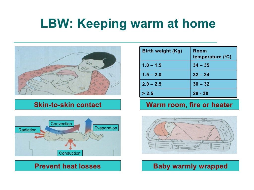 Management of lbw low birthweight babies