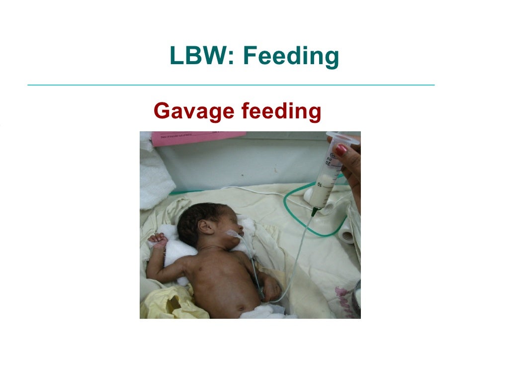 Management of lbw low birthweight babies