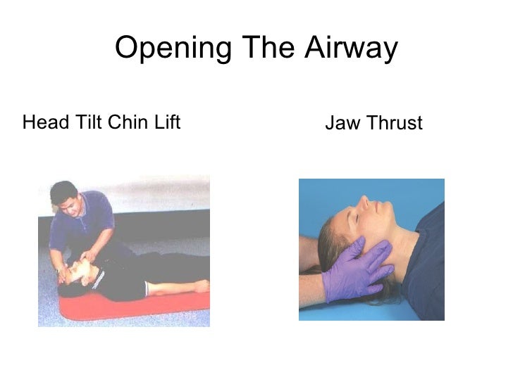 Management of life threatening conditions