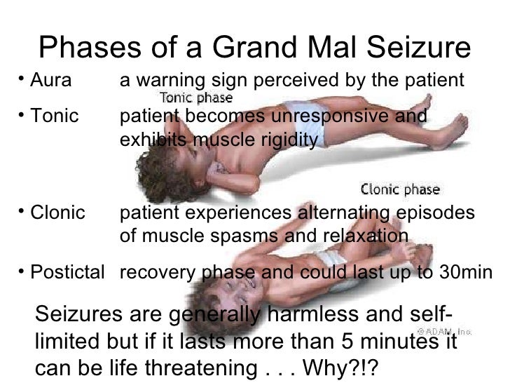grand mal seizure management of threatening conditions grand mal seizure management of threatening conditions