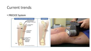 Management of LLD and bone gaps | PPTX