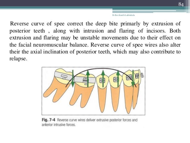 curve of spee