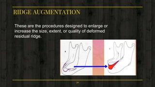 RIDGE AUGMENTATION
These are the procedures designed to enlarge or
increase the size, extent, or quality of deformed
residual ridge.
30
 