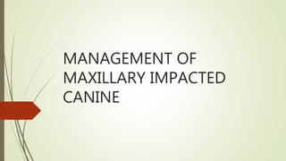 MANAGEMENT OF
MAXILLARY IMPACTED
CANINE
 