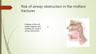 Management of maxillofacial trauma | PPTX