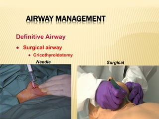 AIRWAY MANAGEMENT
● Surgical airway
● Cricothyroidotomy
Needle
Definitive Airway
Surgical
 