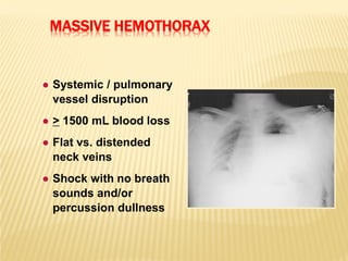MASSIVE HEMOTHORAX
● Systemic / pulmonary
vessel disruption
● > 1500 mL blood loss
● Flat vs. distended
neck veins
● Shock with no breath
sounds and/or
percussion dullness
 