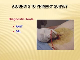 ADJUNCTS TO PRIMARY SURVEY
Diagnostic Tools
● FAST
● DPL
 