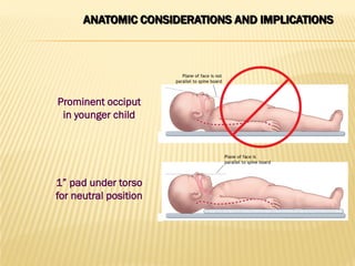 ANATOMIC CONSIDERATIONS AND IMPLICATIONS
Prominent occiput
in younger child
1” pad under torso
for neutral position
 