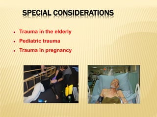 SPECIAL CONSIDERATIONS
● Trauma in the elderly
● Pediatric trauma
● Trauma in pregnancy
 