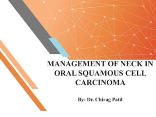 MANAGEMENT OF NECK IN
ORAL SQUAMOUS CELL
CARCINOMA
By- Dr. Chirag Patil
 